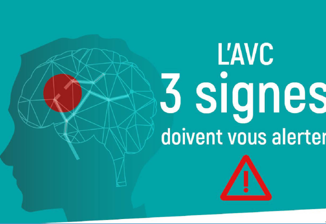 AVC 3 signes doivent vous alerter